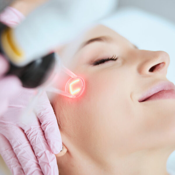 Fractional Laser (littekentherapie)